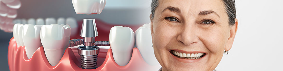 Cosmetic Dentistry in The Woodlands, TX